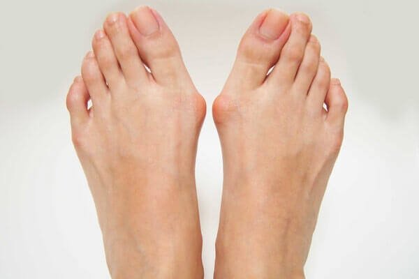 Thickened Curved Toenails  Well Heeled Podiatry Hampton